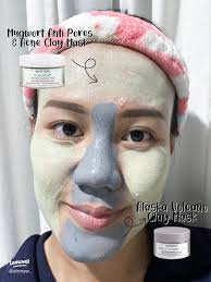 Mengatasi Jerawat dan Komedo dengan Dua Clay Mask Skintific