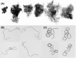 Today the question is why does curly hair curl? The Biology And Genetics Of Curly Hair Westgate 2017 Experimental Dermatology Wiley Online Library