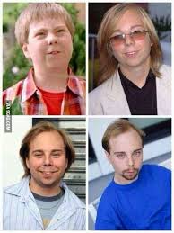 Steven anthony lawrence lived this struggle. Puberty Done Wrong Steven Anthony Lawrence Aka Beans Is 24 Years Old And Is 5 1 At Least He S A Millionaire 9gag