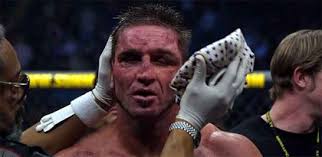 Ken Shamrock loses another UFC fight (in court)