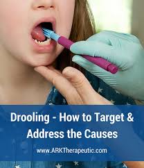 نتیجه جستجوی لغت [drooling] در گوگل