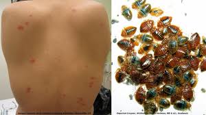 Bed bugs release pheromones, and when in large numbers, the smell can be quite strong. How To Find Out If You Have Bed Bugs Discreetly Surge Protector Bed Bug Trap Review Youtube