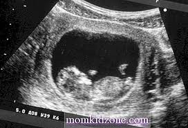 Mungkin ibu akan memperhatikan betapa sempurna dan sehatnya si kecil. Apabila Anda Dapat Melihat Bayi Pada Imbasan Ultrasound Kehamilan 2021