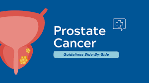 Image result for Prostate Cancer Staging
