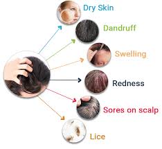Although this is somewhat not harmful, it can be very irritating and disturbing. Itchy Scalp Don T Scratch Use These Insightful Remedies To Treat Itchy Scalp Ak Clinics