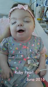 Prayers For Baby Ruby