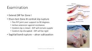 Image result for Elson Extensor Tendon Test