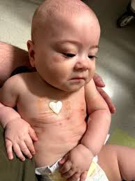 Every hospital stay, every ER visit, every scan, every poke, every surgery,  every therapy, every dose of chemo, every day of radiation, every  medication, every milestone in the last 3 years Caleb