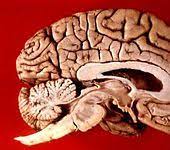Visible are the structures situated on the medial aspect of the cortex as well as subcortical areas, which include the corpus callosum, septum pellucidum, fornix, diencephalon, and brainstem structures. Datei Human Brain Midsagittal View Description Jpg Wikipedia