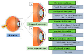 Pharmaceutics | Free Full-Text | Recent Advances of Ocular Drug Delivery  Systems: Prominence of Ocular Implants for Chronic Eye Diseases