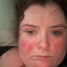 Woman with rare condition 'trapped' in unsuitable home says council is  'playing with her life'