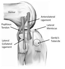 It is also known as articular ligament, articular larua, fibrous ligament, or true ligament. Anatomy 101 Anterolateral Ligament Rotational Stability Of The Knee Rayner Smale