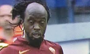Us $36.00  14 bids shipping: The 10 Best Pictures Of Gervinho S Shocking Hair Unbelievable Talksport