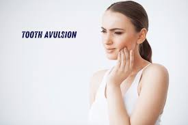 Image result for Tooth Avulsion