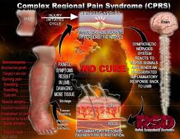 Pin On Sassy Cause Hope For Rsd Crps Awareness