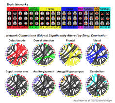 Sleep Deprivation Alters Brain Connectivity Neuroskeptic Sleep Deprivation Neuroscience Brain