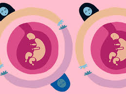 Es decir, la función de la gestante es solo la de gestar, sin aportar sus óvulos. Cuando Tu Madre No Te Pario Por Paula Siverino Opinion El Comercio Peru