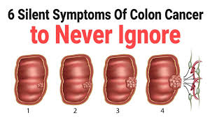 These problems also may occur with frequent gas and abdominal pain. 6 Silent Symptoms Of Colon Cancer To Never Ignore
