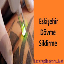 Eskisehir Dovme Sildirme Lazer Epilasyonu Lazer Epilasyon Fiyatlari Merkezleri Ve Cihazlari