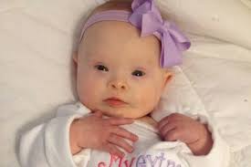 Fundraiser by Sydnie Eileen Bill : Everly needs a Medical Band