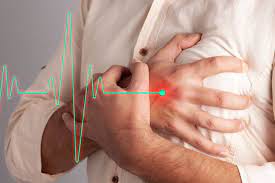 Myocardial infarction, acute myocardial infarction, mi, ami) adalah terhentinya aliran darah, meskipun hanya sesaat, yang menuju ke jantung, dan mengakibatkan sebagian sel jantung menjadi mati. 4 Tanda Penyakit Jantung Tanpa Gejala Halaman All Kompas Com