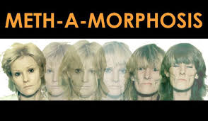 In recent years, the recreational use of methamphetamine has skyrocketed in the united states. Meth Mouth And Crank Bugs Meth A Morphosis Nida Archives