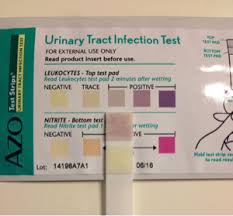 how to read test strips for uti