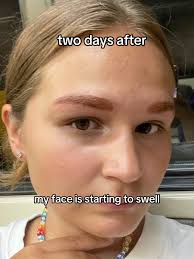 Eyebrow Tint Allergy Remedy