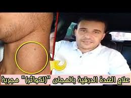 علاج الغدة الدرقية بالمجان لكواثر مجربة مع الباحث في الأعشاب محمد زين الدين Youtube Health Incoming Call Incoming Call Screenshot