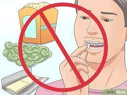 Check spelling or type a new query. How To Make Your Braces Hurt Less With Pictures Wikihow