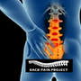 The Back Pain Project from m.youtube.com