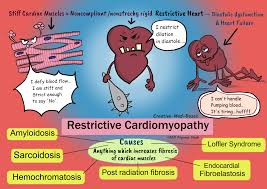 Image result for Restrictive Cardiomyopathy