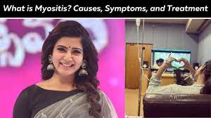 What Is Myositis, The Autoimmune Condition Actress Samantha Ruth Prabhu Is  Suffering From?