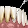 Dental Scaling product image