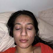 JEAN ACUNA SKIN THERAPY