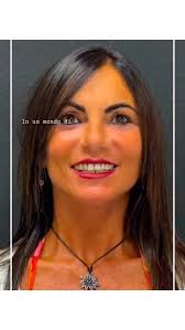 Rinoplastica a tre mesi La bellezza ritrovata ... e mai perduta.  www.paolovittorini.it Telefono: 800300325 #paolovittorini