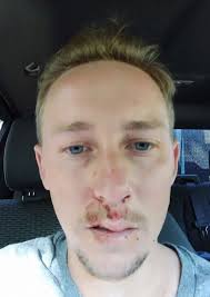 I nearly died just from drinking WATER to cool down in heatwave