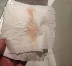 The 7 weeks of pregnancy period as the second month or the first trimester. Can You Have Pink Discharge And Be Pregnant