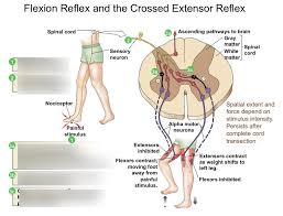 Image result for Crossed-Leg Test