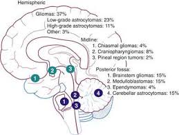 Compression, invasion, destruction of parenchyma arterial and venous hypoxia competition for. Brain Tumors In Childhood Clinical Gate