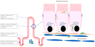 Image result for Intestinal Enteropathy