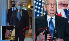 — ☇riotwomenn☇ (@riotwomennn) october 23, 2020. Mitch Mcconnell 78 Denies Health Problems Despite Bruised Hands Daily Mail Online