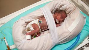 Molnlycke Z Flo Fluidized Positioner For Neonatal Intensive Care Device Molnlycke