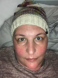 An MS Miracle for Nina