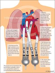 The Berlin Heart Medical Knowledge Respiratory Care Cardiology Study