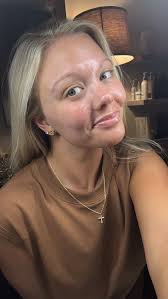 ✨Come with me to @terrell_aesthetics to get a hydrafacial , @hydrafacial is  a medical grade facial that deep cleanses, extracts painlessly, rehydrates  and infuses your skin with hyaluronic acid and ...