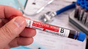 Hepatitis b dapat menyebar dengan mudah, biasanya hepatitis b menyebar melalui: Lifepack Mengenal Penyakit Hepatitis B Perhatikan Gejala Dan Cara Mencegahnya Halaman 3 Surya