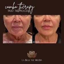 TOP 10 BEST Botox Injections near Reseda, Los Angeles, CA