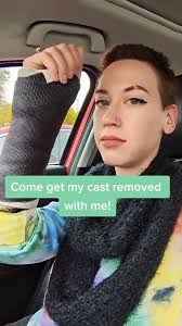 All my arm hair is black now from lack of sun lol #wrist #surgery #cas...