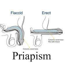 Image result for Priapism
